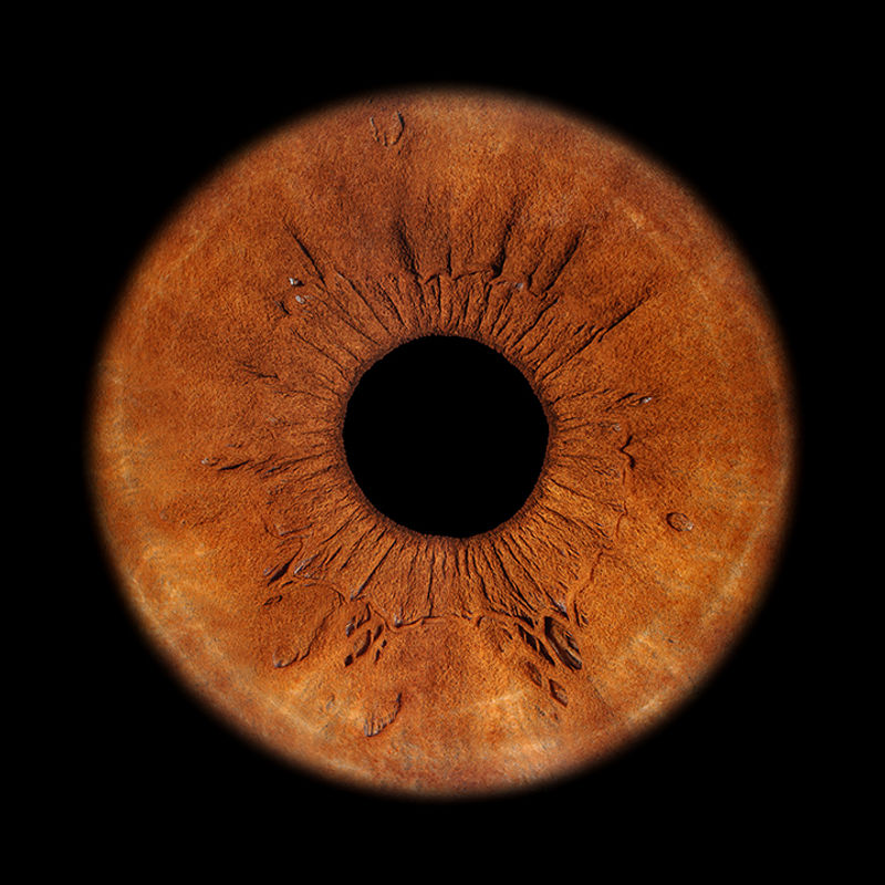 Braune Iris mit äusseren Dehnungsstreifen und blauem Untergrund