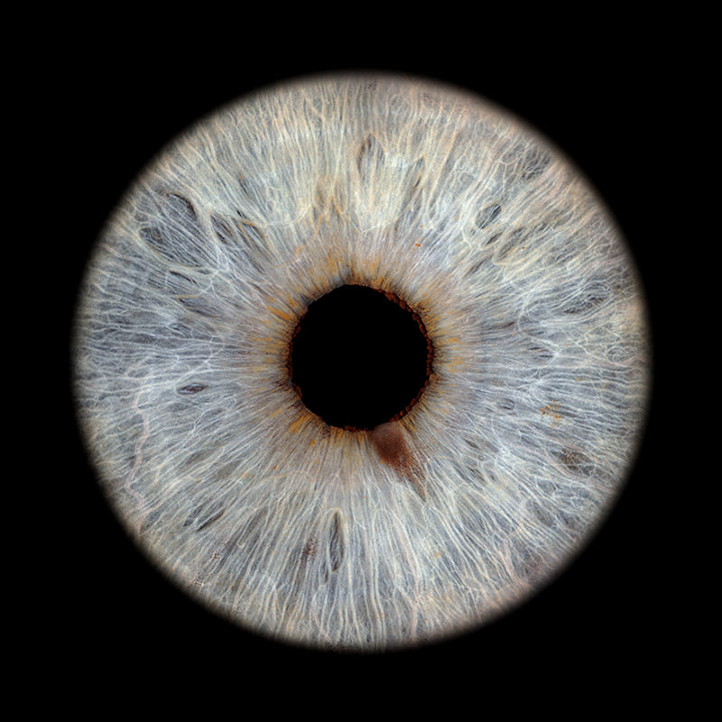 Iris mit muttermal-ähnlichem Fleck am Iris-Saum – Tiefen der Persönlichkeit